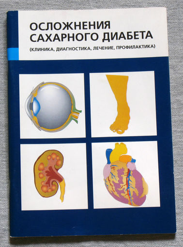 Осложнения сахарного диабета. ( клиника, диагностика, лечение, профилактика)