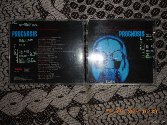 Various – Prognosis. Сборник Неопрог-Рока И Прогрессив-Металла /CD