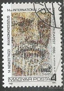 Венгрия. Онкологический конгресс. Мориц Капоши. Врач. 1986г. Mi#3835.