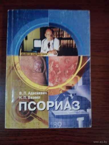 Псориаз