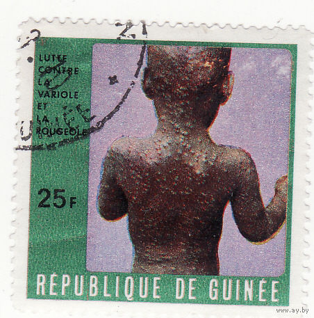 Борьба с оспой и корью 1970 год